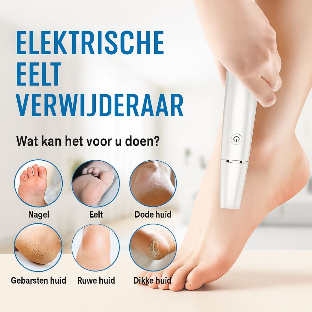 Elektrische eelt verwijderaar